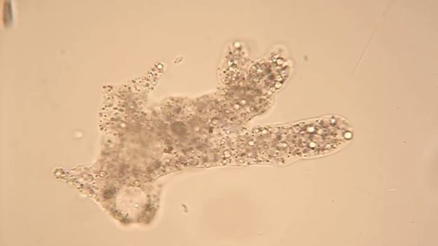 Live Amoeba Proteus Showing Amoeboid Movement