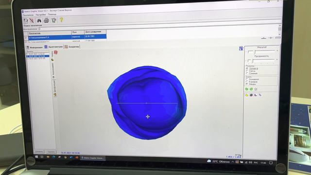 3 часть. Почему при вирусном поражении страдают психика, дыхательная и сердечно-сосудистая системы смотреть онлайн