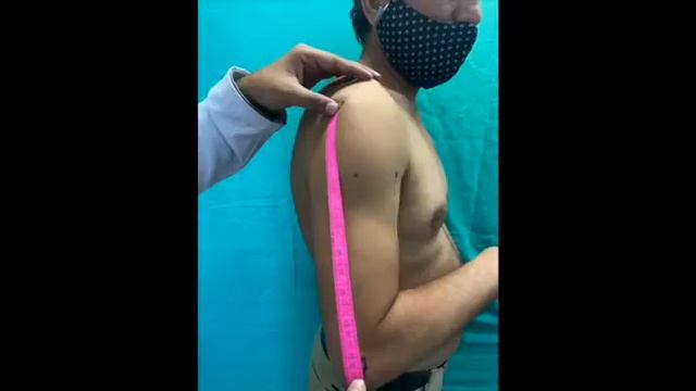 Elbow Short Case смотреть онлайн