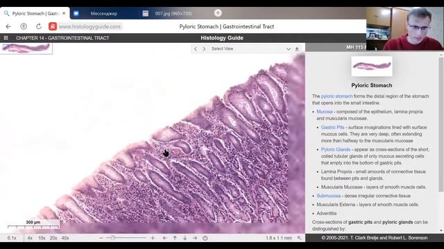 ИНТЕНСИВ (№10): разбор микропрепаратов.