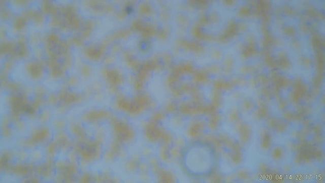 Кровь и изменение ее агрегатного состояния в течение суток Часть 3 смотреть онлайн