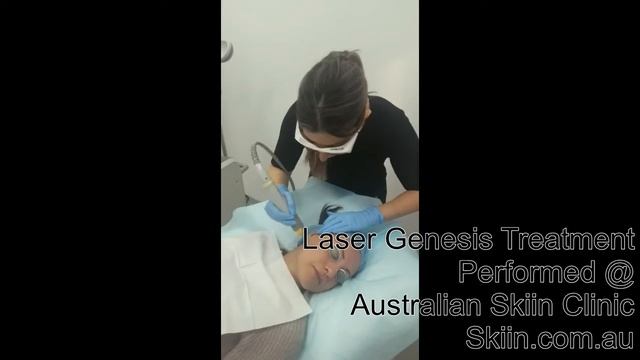 Skiin Cutera laser genesis смотреть онлайн