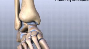 3D обзор ГОЛЕНОСТОПНЫЙ СУСТАВ