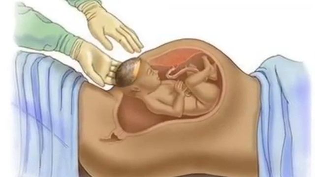ABORTning turlari va oqibatlari смотреть онлайн