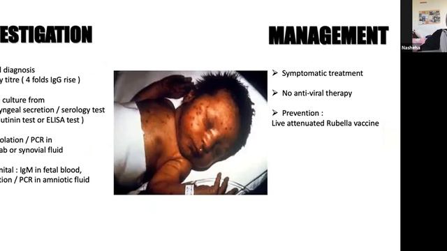 Online teaching with Dr Syed 15/8/2020 (Seminar virology) смотреть онлайн