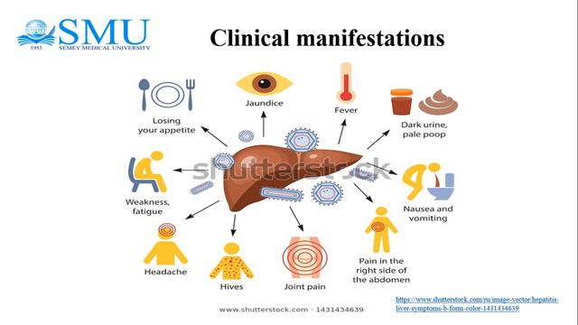№19 Hepatitis viruses смотреть онлайн