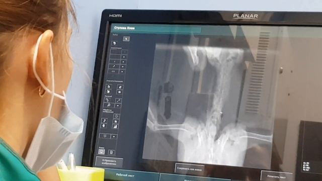 СЕМЬ ПОПУГАЕВ ПРОШЛИ ДИСПАНСЕРИЗАЦИЮ! ЗАЧЕМ ОБСЛЕДОВАТЬ ПОПУГАЕВ ПОСЛЕ ПОКУПКИ? КАК ДАТЬ ЛЕКАРСТВА. смотреть онлайн