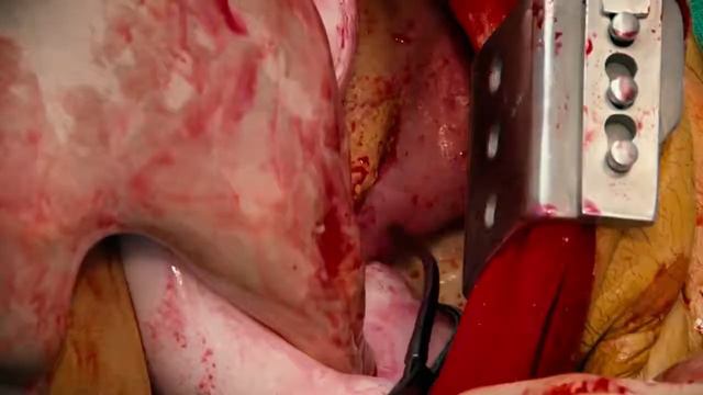 Медицинские тренажеры симуляторы на сайте medmaket.ru смотреть онлайн