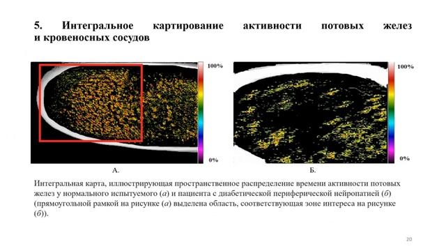 Семинар "Интегральное картирование потовых пор и кровеносных сосудов методом..." от 26.09.22 смотреть онлайн