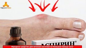 Народное Средство Для Лечения Косточки На Большом Пальце Ноги – топ лайфхаки