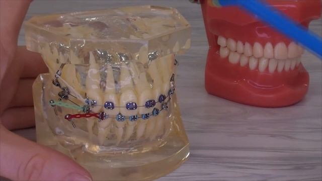 Монопучковая зубная щётка смотреть онлайн