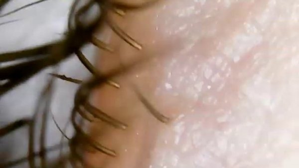 Ресницы и глаз под микроскопом.Eyelashes and eye under the microscope.??