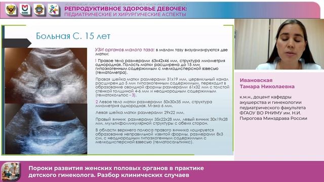 Ивановская Т Н Пороки развития женских половых органов в практике детского гинеколога Разбор кл смотреть онлайн