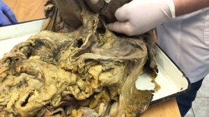 Анатомия. Печень, Селезёнка и Поджелудочная Железа (Ч1).