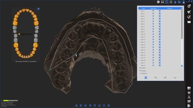 Impression Scan with One Side Arch смотреть онлайн