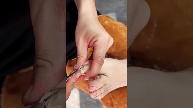 Toenail cutting || Ingrown toenail removal asmr || tickle feet || 레 푸스【Predicure ASMR】 смотреть онлайн