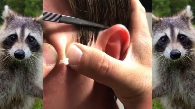 Мерзкое видео ? | чёрные точки в ушах. У тебя тоже есть такие ! ???Blackheads extraction смотреть онлайн