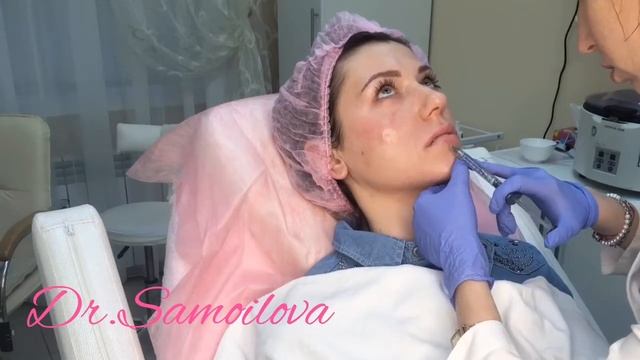 Описание процедуры Full Face смотреть онлайн