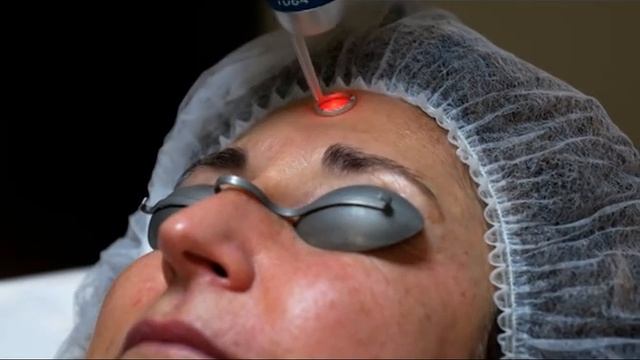 Tratamiento y resultados de rejuvenecimiento facial con láser de picosegundos смотреть онлайн