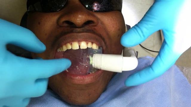 Isolite's IsoVac Isolation system vs the DryShield Isolation system смотреть онлайн