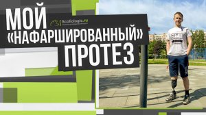 Попал под поезд и потерял ногу. История школьника из Вологодской области