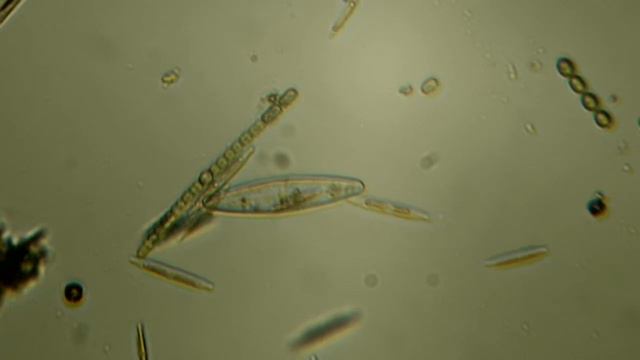 Огромная диатомея под микроскопом. A huge diatom under a microscope. смотреть онлайн