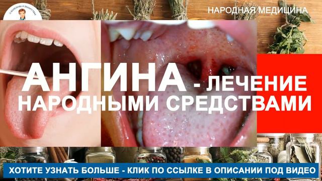 болит горло когда глотаешь смотреть онлайн