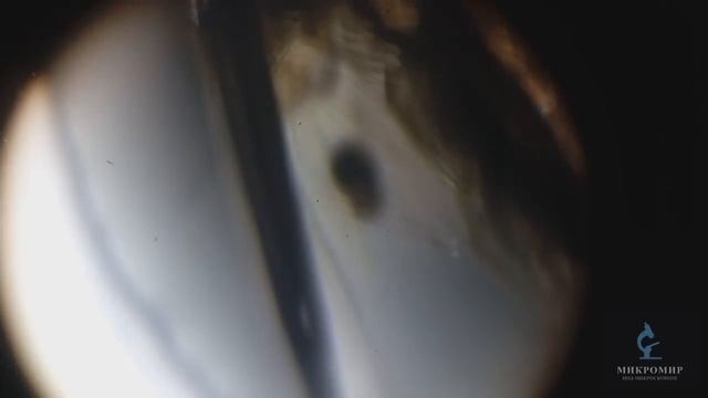Личинка комара под микроскопом смотреть онлайн