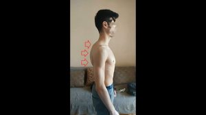 Лечение Кифоза Грудного Отдела Позвоночника 3 степени у Остеопата