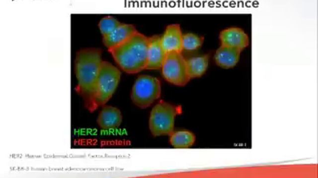 Webinar: Detection of Long Noncoding RNAs by Stellaris FISH Probes