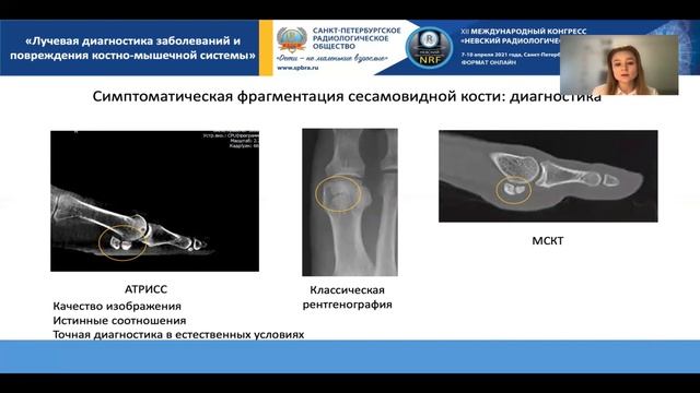 Научная секция «Лучевая диагностика заболеваний и повреждения костно-мышечной системы» смотреть онлайн