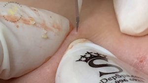 Satisfying Relaxing with Sac Dep Spa Video (#300) #SacDepSpa