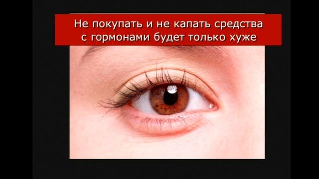 Кератит. Блефарит.Коньюктивит. смотреть онлайн