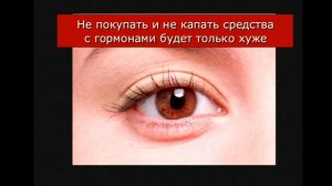 Кератит. Блефарит.Коньюктивит.