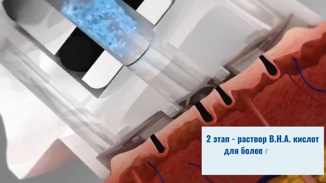 Авкапилинг на аппарате ProFacial смотреть онлайн
