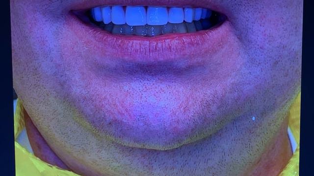 Разбор кейса До-После смотреть онлайн