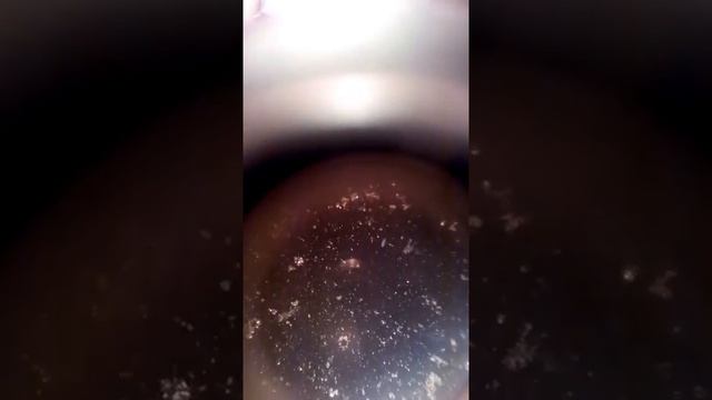 КАПЛЯ ЛУЖИ ПОД МОИМ МИКРОСКОПОМ - ИНФУЗОРИЯ ТУФЕЛЬКА!!!!!!!!!! смотреть онлайн