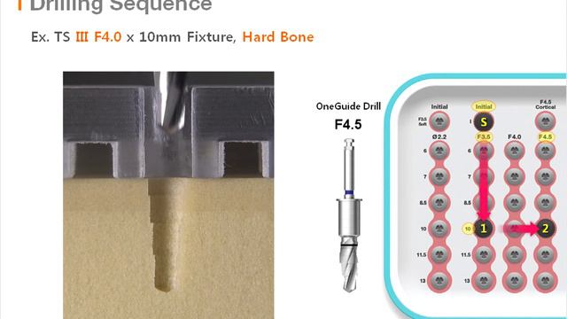 Osstem OneGuide Kit Drill Sequence смотреть онлайн
