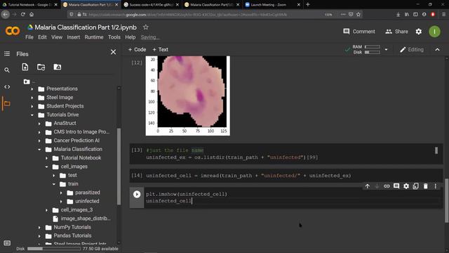 CMS - Intro to AI Malaria Dataset Part 1 смотреть онлайн
