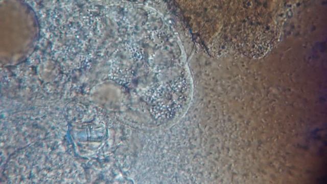 Рой бактерий разлагает биологические остатки смотреть онлайн