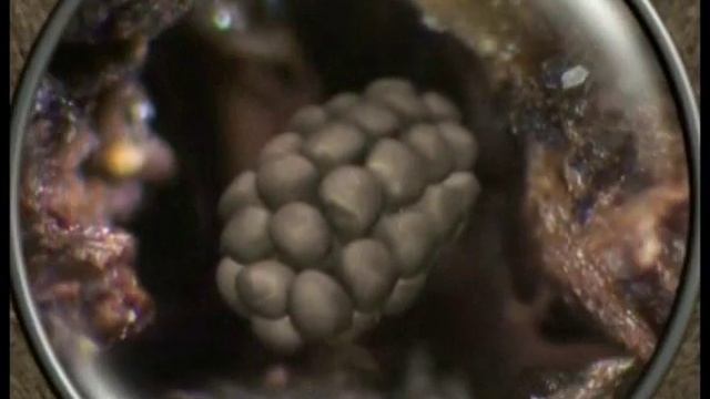 Болезнь сахарной свеклы (Ризомания) смотреть онлайн