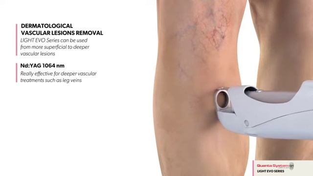 Light EVO Series смотреть онлайн