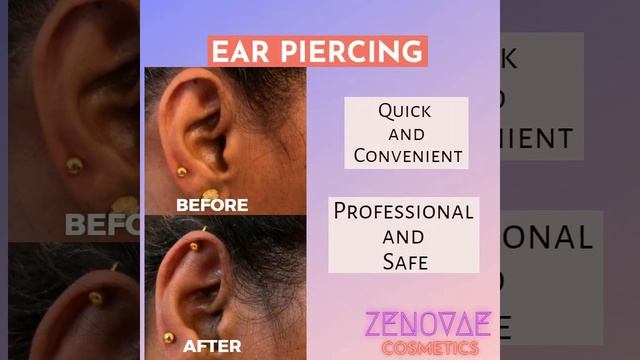 ZENOVAE (Microblading - eyebrows, Permanent lip colour , Ear piercing, Ear piercing repair) смотреть онлайн