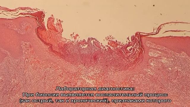 Все о болезнях ушной раковины