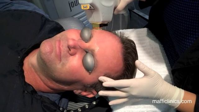 Maffi Clinics: BBL for Men смотреть онлайн