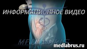 Паховая грыжа