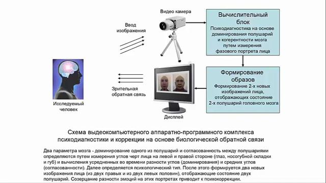 Ануашвили. Как происходит коррекция с помощью видео-компьютерного метода смотреть онлайн