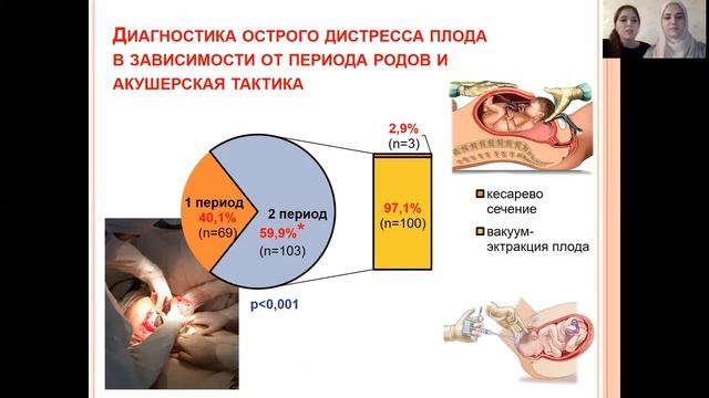 ОСТРЫЙ ДИСТРЕСС ПЛОДА В РОДАХ ПРИ ДОНОШЕННОЙ БЕРЕМЕННОСТИ смотреть онлайн