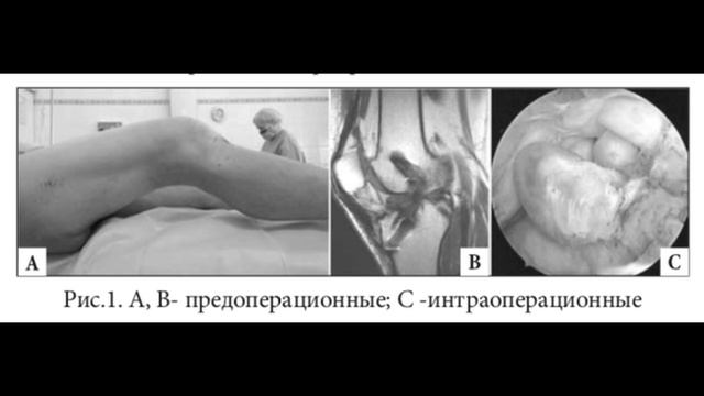Часть 56. 10 фактов о родной ПКС. смотреть онлайн