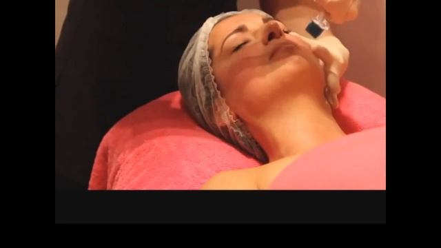 Как пользоваться мезороллером смотреть онлайн